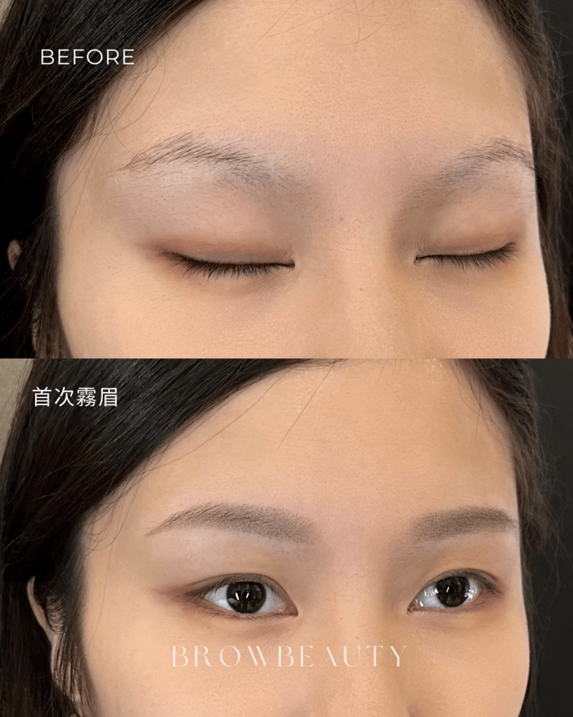 毛流稀疏後霧眉對比