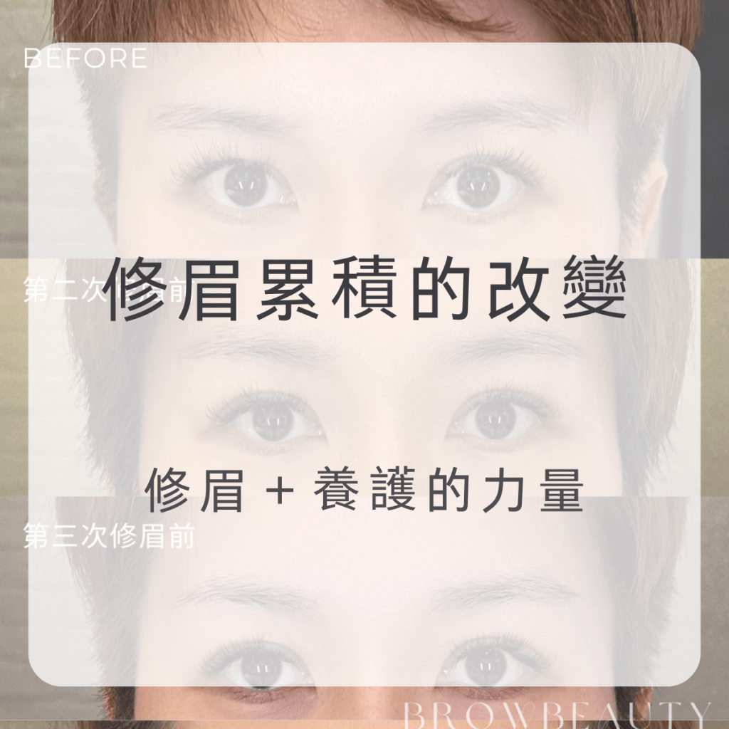 固定修眉能改善眉型嗎？真實案例分享