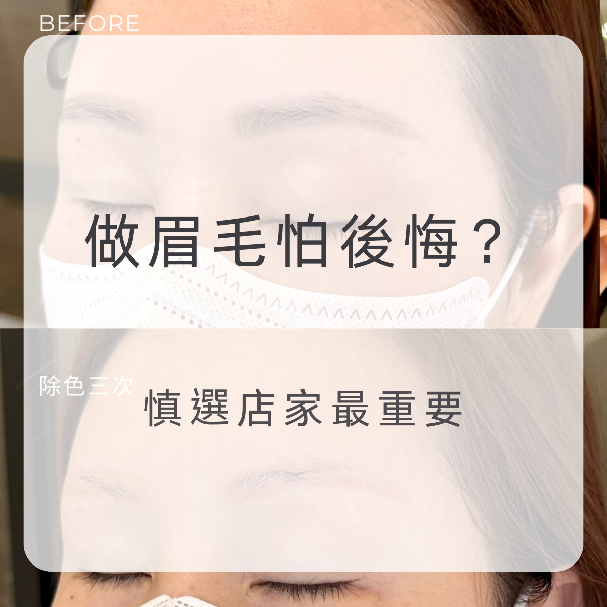 眉毛除色真相,慎選店家很重要