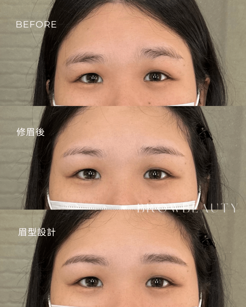 這個案例原本有高低眉與眉峰不一致的情況。
設計時不是套用固定眉型，而是依照原生條件去調整角度與比例。